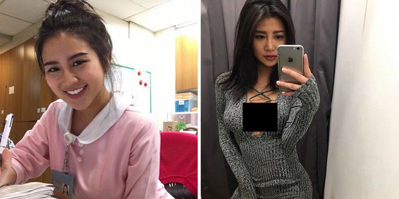 Nitezen Terkagum, Hingga Memberi Gelar Suster Paling Seksi