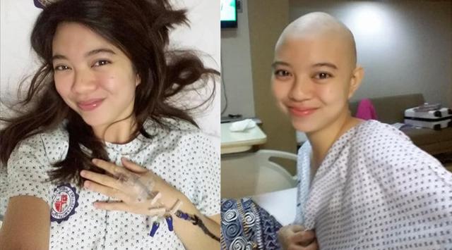 Anggap Sepele Sembelit Seorang Gadis Dikejutkan dengan Pernyataan Dokter
