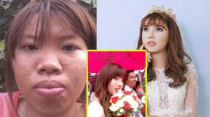 Dulu Sering Dibully Wajah Baru Gadis Vietnam Ini Bikin Netizen Melongo