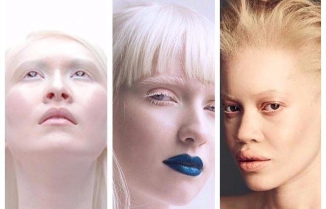Kenalan dengan 3 Model Albino Beda Ras, Salah Satunya Albino Tercantik di Dunia