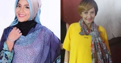 5 Seleb Tanah Air Yang meninggal karena kanker payudara