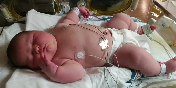 Bayi seberat 6 Kilogram Pemegang Rekor Bayi Terbesar di Dunia!!