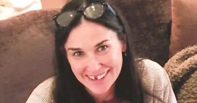 Demi Moore Kehilangan Gigi nya Gara Gara Stres