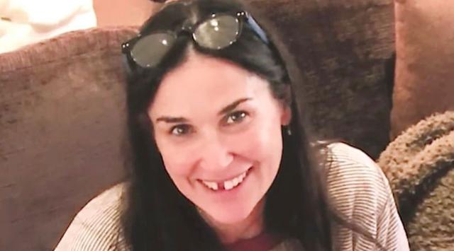Demi Moore Kehilangan Gigi nya Gara Gara Stres