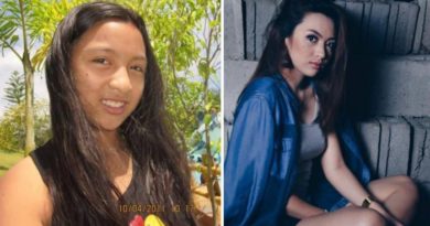 Mengalami Pubertas dari Gadis Biasa Menjadi Istimewa Gadis Cantik Ini Di Cibir
