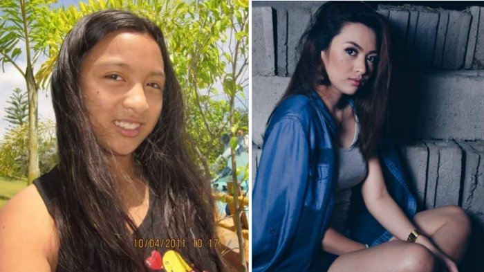 Mengalami Pubertas dari Gadis Biasa Menjadi Istimewa Gadis Cantik Ini Di Cibir