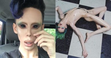 Pria Ini Nekat Jalani 110 Kali Operasi Karena Ingin Jadi Alien Tanpa Kelamin