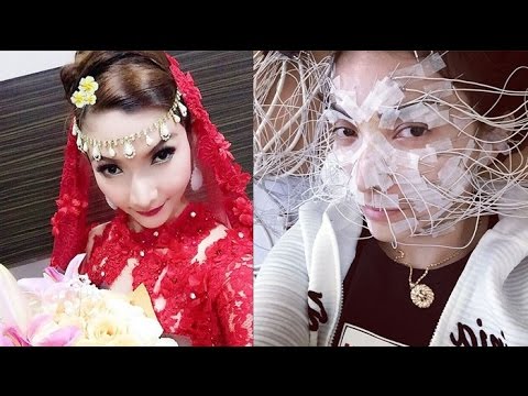 Serem, Perawatan Ala Roro Fitria Yang Penuh Dengan Kabel