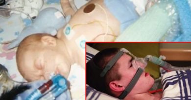 ASTAGA, SETIAP TIDUR NAFASNYA BERHENTI BEGINI CARANYA PRIA INI BERTAHAN HIDUP
