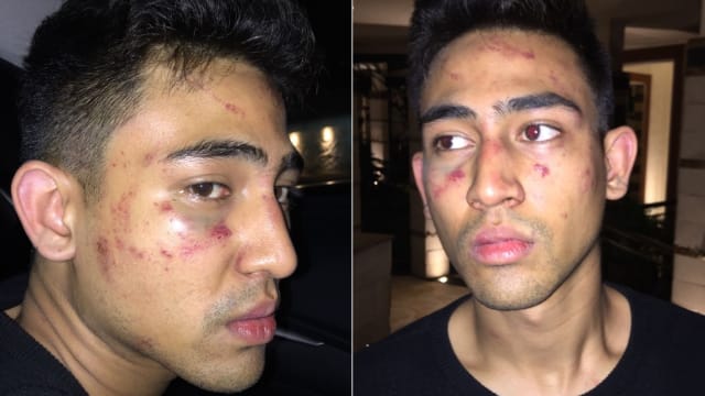 AXEL MATTHEW THOMAS DI TES URINE HASILNYA NEGATIF NARKOBA
