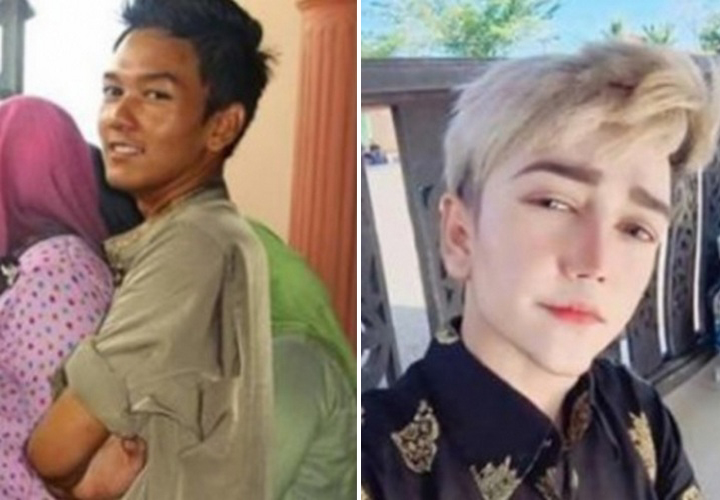 HABISKAN RP 622 JUTA JUTA UNTUK OPLAS DEMI WAJAH ANIME FINAL FANTASY