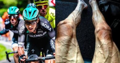 HEBOH, ATLET INI UNGGAH FOTO MENGERIKAN EFEK DARI BALAPAN SEPEDA