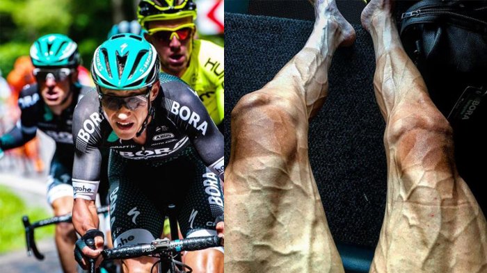 HEBOH, ATLET INI UNGGAH FOTO MENGERIKAN EFEK DARI BALAPAN SEPEDA