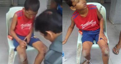 Miris Warga Menemukan Bocah Dianiaya Lalu Dirante