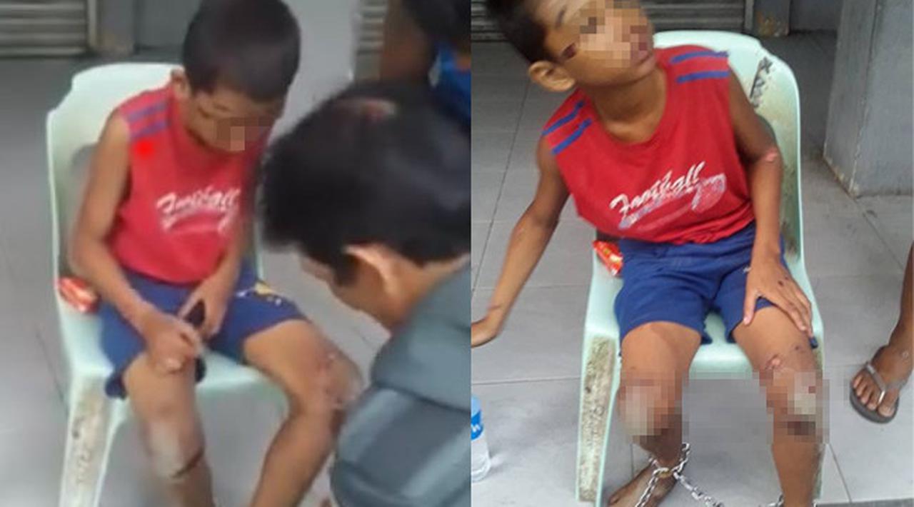 Miris Warga Menemukan Bocah Dianiaya Lalu Dirante