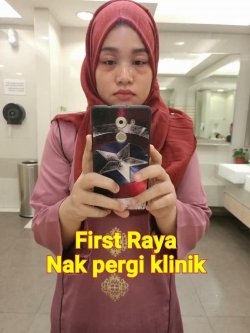 WANITA INI ALAMI HAL MENGERIKAN SETELAH MEMAKAI EYESHADOW