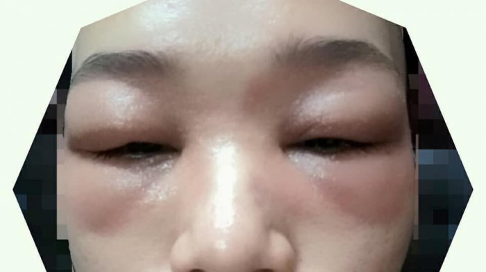 WANITA INI ALAMI HAL MENGERIKAN SETELAH MEMAKAI EYESHADOW