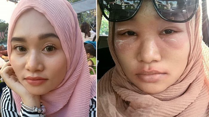 WANITA INI ALAMI HAL MENGERIKAN SETELAH MEMAKAI EYESHADOW