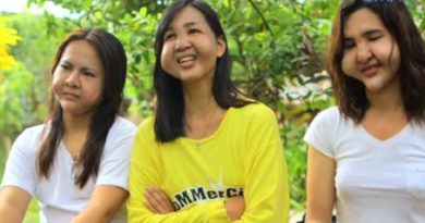 Akibat Filler Sembarangan Para Wajah Transgender ini Malah Hancur