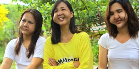 Akibat Filler Sembarangan Para Wajah Transgender ini Malah Hancur