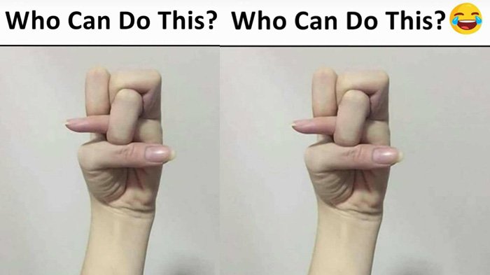 Heboh dan Bingung Bisa Lipat Jarimu Jadi Seperti Ini?
