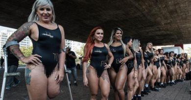 Miss Bumbum Rubia Machado yang Hanya Memiliki satu kaki.