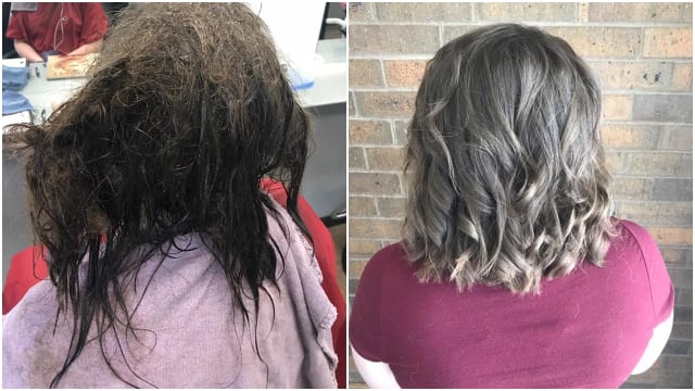 Perubahan Rambut Gadis 16 Tahun yang Alami Depresi