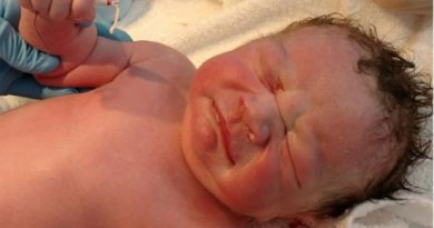 Seorang Bayi Lahir dengan Memegang Alat Kontrasepsi Ibunya