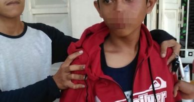 Viral Gara-Gara Senggol Spion Mobil Remaja Ini di Pukul