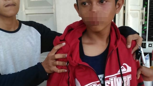 Viral Gara-Gara Senggol Spion Mobil Remaja Ini di Pukul