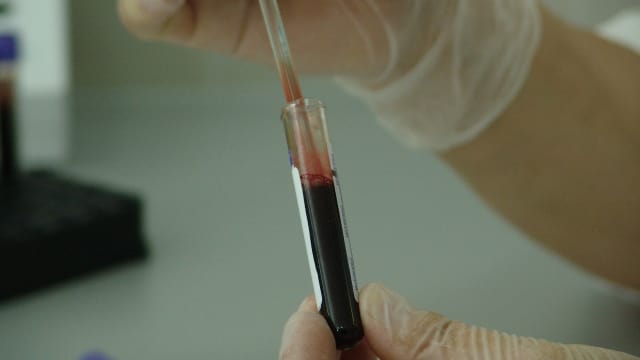 Wajah Anak Terlalu Tampan Sang Ayah Curiga Minta Tes DNA