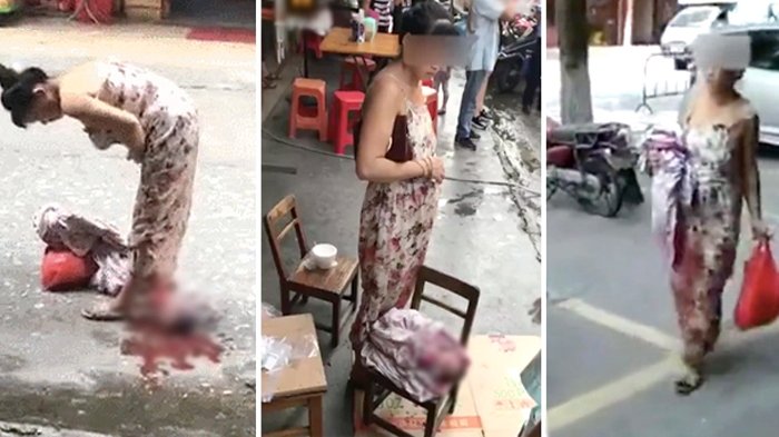 Ibu Ini Melahirkan di Pinggir Jalan Karena Air Ketuban Pecah