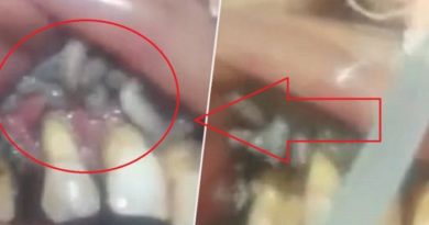 Dokter Gigi Ini Kaget Saat Temukan Hewan Mengerikan di Dalamnya