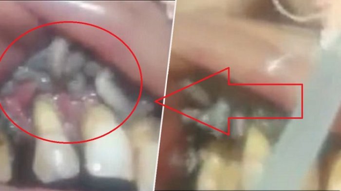 Dokter Gigi Ini Kaget Saat Temukan Hewan Mengerikan di Dalamnya