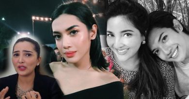 Keponakan Ashanty Millen Cyrus Jalani Tanam Benang Hidung