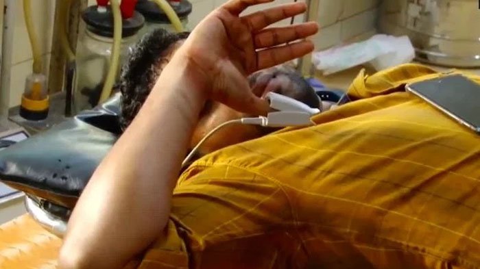 Meski Dokter Bisa Sambungkan, Alat Vital Pria Ini Nyaris Putus