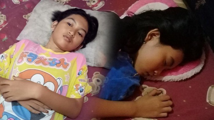 Viral Kisah Echa Si Putri Tidur Yang Terlelap Sampai 13 Hari