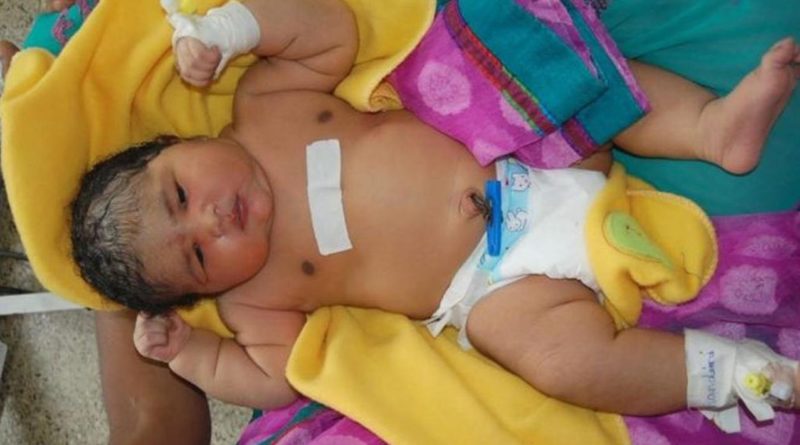 Dengan Waktu 15 Menit Bayi Seberat 6,7 Kg Lahir Secara Normal