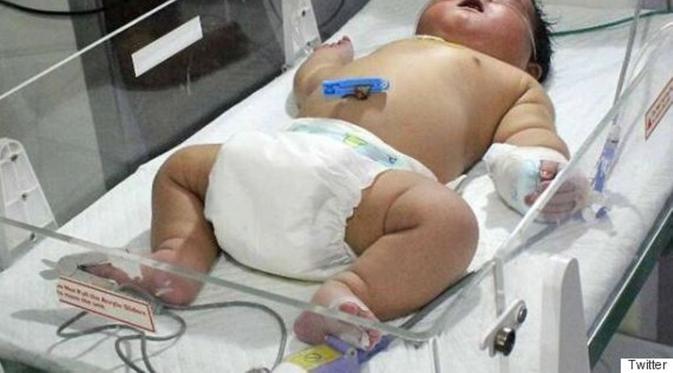 Dengan Waktu 15 Menit Bayi Seberat 6,7 Kg Lahir Secara Normal