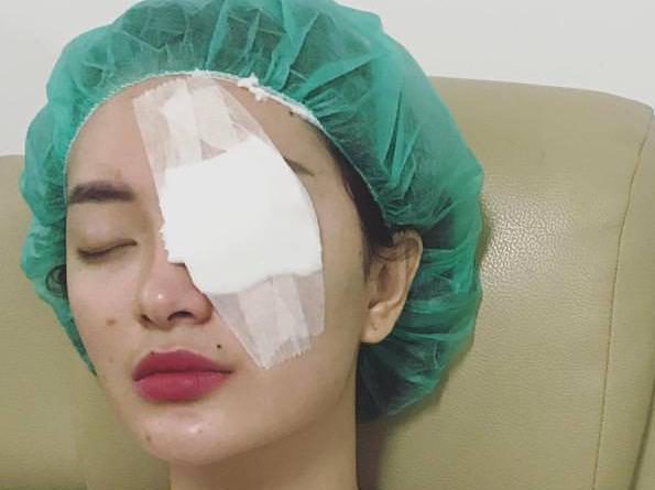Mata Dibalut Perban Zaskia Gotik Jalani Operasi