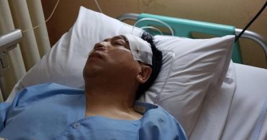 Setya Novanto Kecelakaan, Tiang Listrik dan Fortuner Jadi Korban