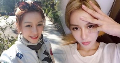 Cantik Setelah 30 Kali Operasi Plastik, Wanita Ini Menyesal Ternyata Ini Wajah Aslinya