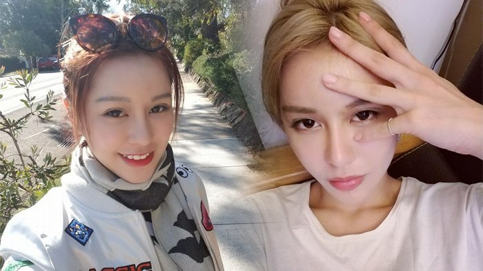 Cantik Setelah 30 Kali Operasi Plastik, Wanita Ini Menyesal Ternyata Ini Wajah Aslinya