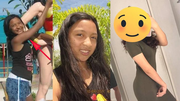Foto Cewek Ini Jadi Viral, Dulu Berkulit Gelap, Saat Dewasa Berubah Drastis