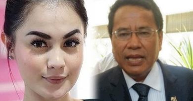 Hotman Paris Beberkan Fakta Mengejutkan Jennifer Dunn Lakukan Oplas