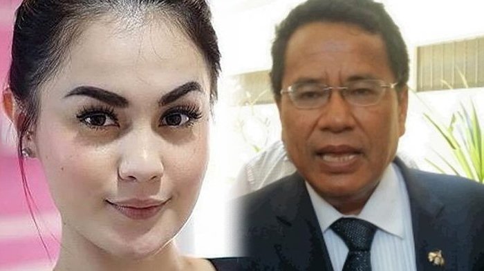 Hotman Paris Beberkan Fakta Mengejutkan Jennifer Dunn Lakukan Oplas