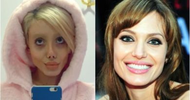 Ingin Mirip Angelina Jolie, Sahar Tabar Operasi Wajah 50 Kali