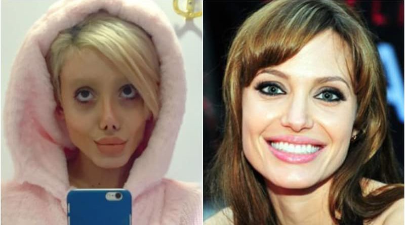 Ingin Mirip Angelina Jolie, Sahar Tabar Operasi Wajah 50 Kali