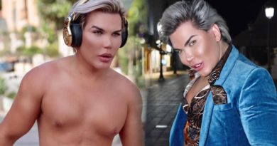 Demi Mirip Boneka Ken Rodrigo Alves, Oplas Sebanyak 60 Kali
