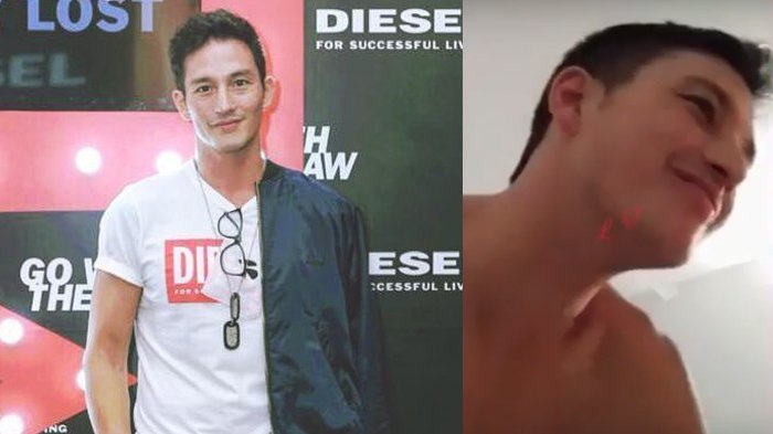 Video Mike Lewis Bersama Wanita di Kamar Beredar di Medsos